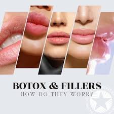 how dermal fillers work