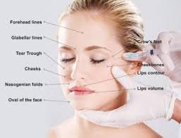 How Long Do Dermal Fillers Last